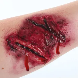 Sliced Arm Scar
