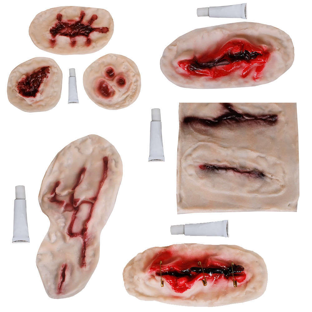 Multiple Scar Bundle