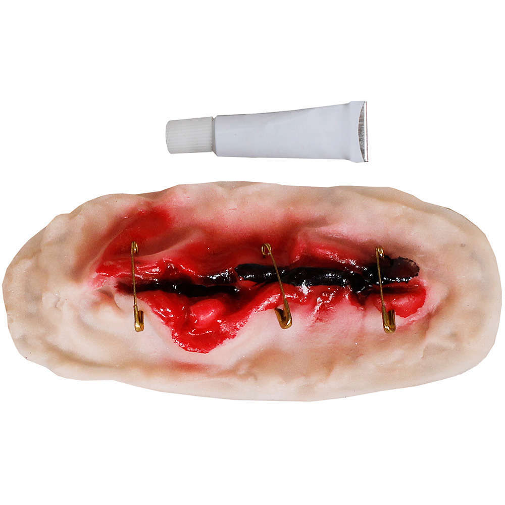 "Un" Safety Pin Scar